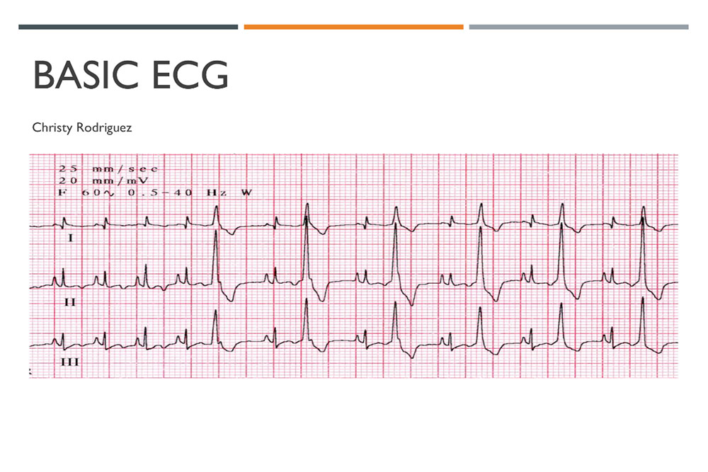 An image titled "BASIC ECG" with the name "Christy Rodriguez" below. The image shows an electrocardiogram (ECG) strip with several heartbeats displayed on a grid background, including standard lead markings I, II, and III—designed specifically for veterinarians to diagnose animal heart health.